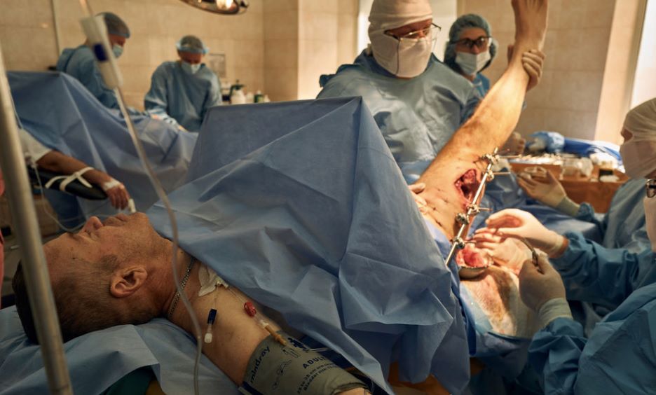 Як в Україні благодійники та бізнес борються з ампутаціями